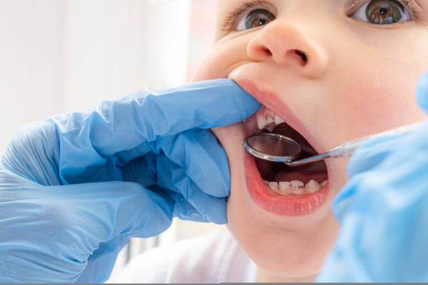 How to prevent cavities with simple daily habits