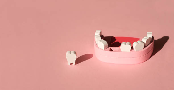 Top reasons to replace missing teeth promptly